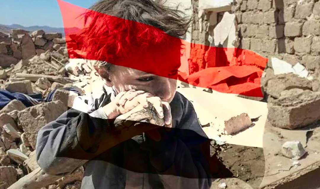 منظمة توجه نداء: الأوضاع في اليمن باتت بمستوى مأساوي خطير