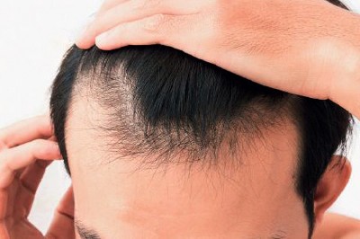 كيف تعالج مشكلة تساقط الشعر؟